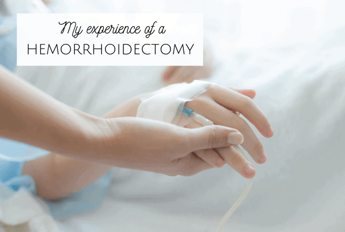 My experience of a hemorrhoidectomy